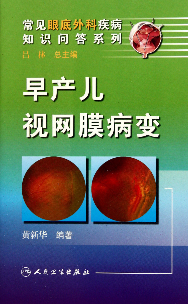 早产儿视网膜病变/常见眼底外科疾病知识问答系列